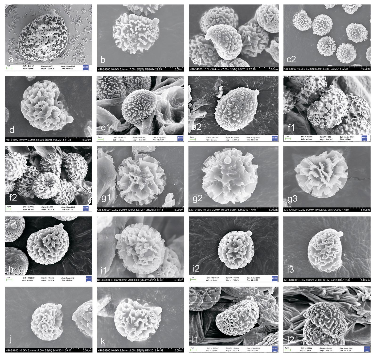 Разные типы спор Strobilomyces