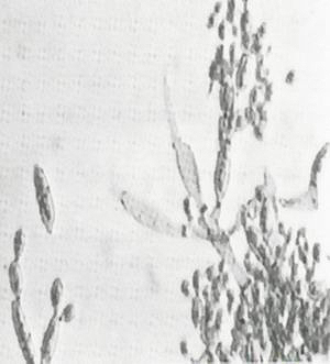 Alternaria под микроскопом